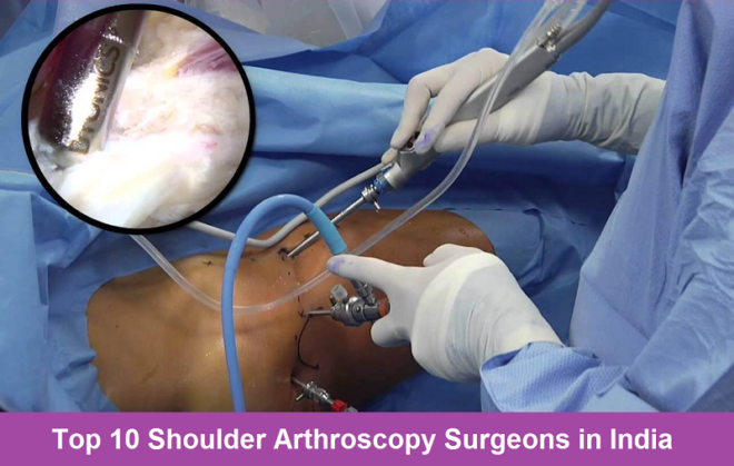 Top 10 Shoulder Arthroscopy Surgeons in India Joint