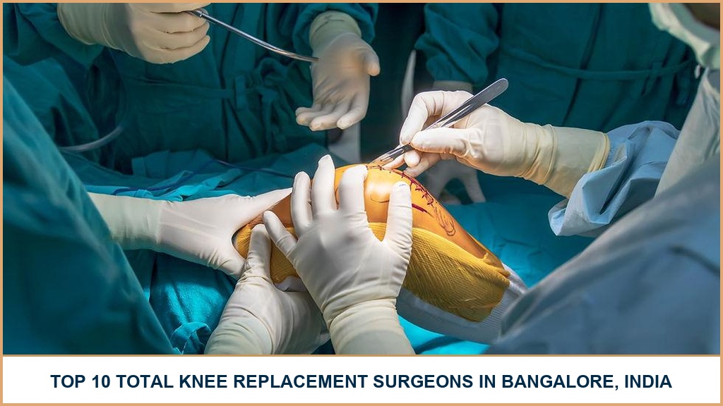 Top 10 Total Knee Replacement Surgeons In Bangalore, India – 2026-2027